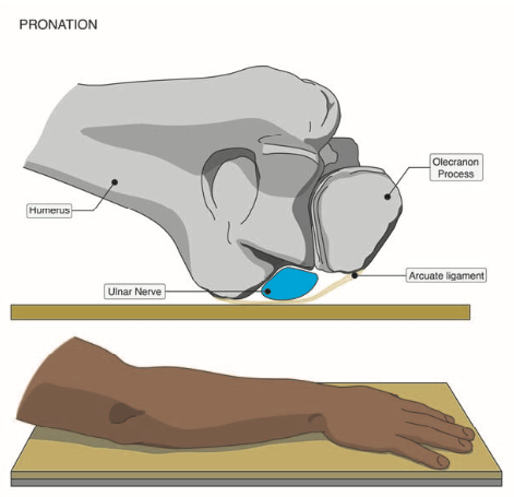 Preventing patient Positioning Injuries in the Non-operating Room Setting