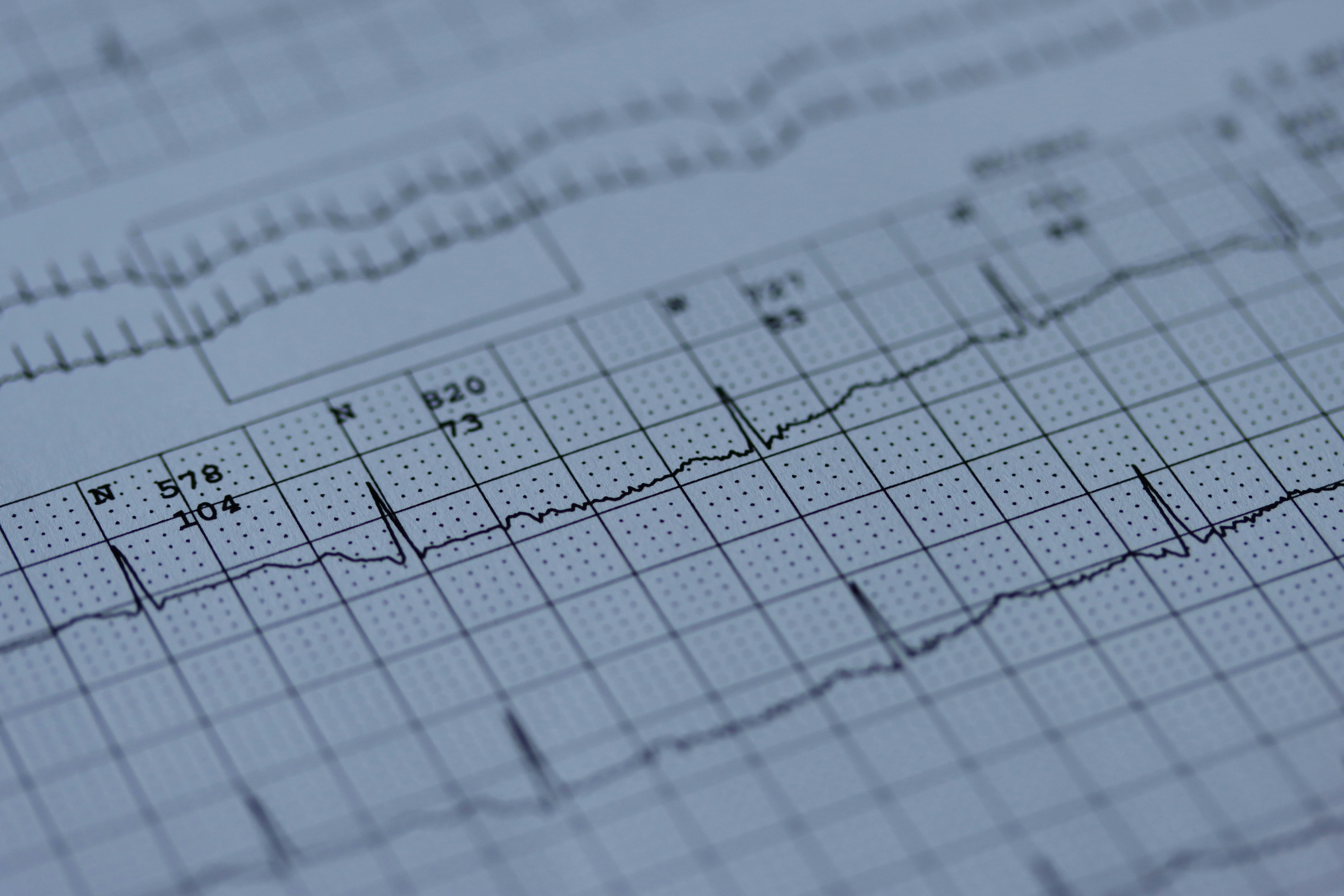 Perioperative Considerations for Patients Undergoing Percutaneous Ablative Therapy for Atrial Fibrillation